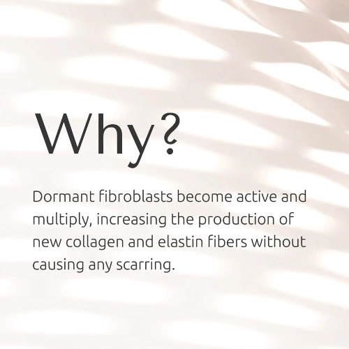 Twist Microneedling Image 4